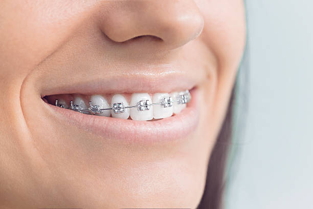 Best Full Mouth Reconstruction  in Lanster, CA
